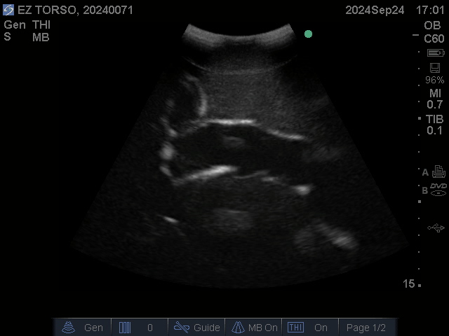 Ultrasound Scans