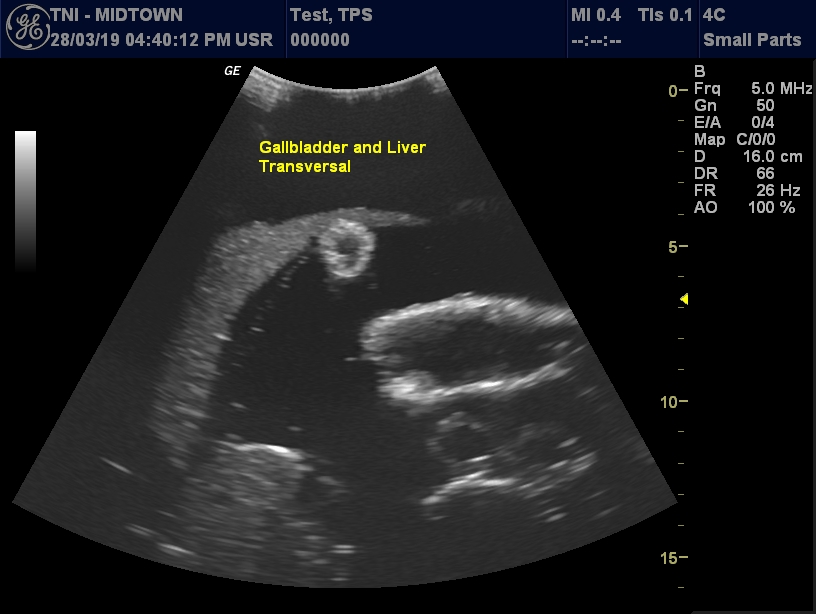 Ultrasound Scans