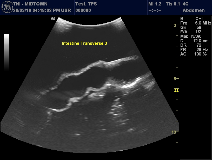 Ultrasound Scans