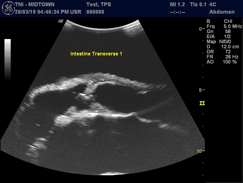 Ultrasound Scans