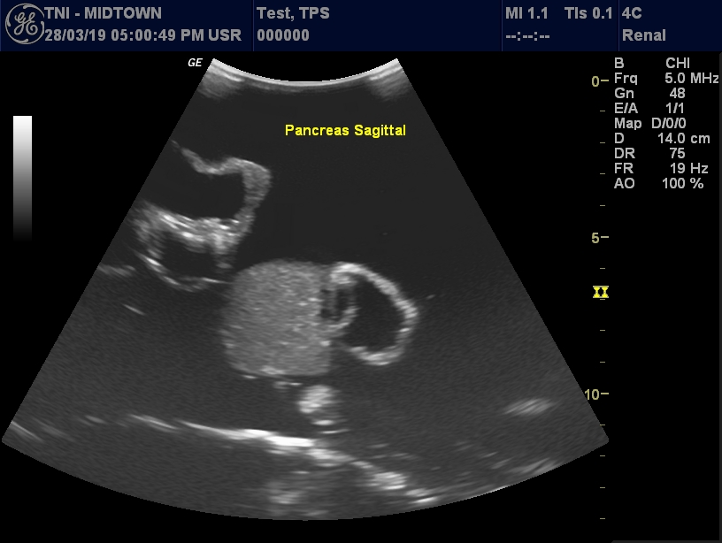 Ultrasound Scans