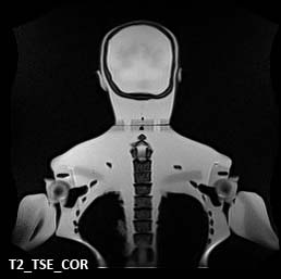 MRI Scans