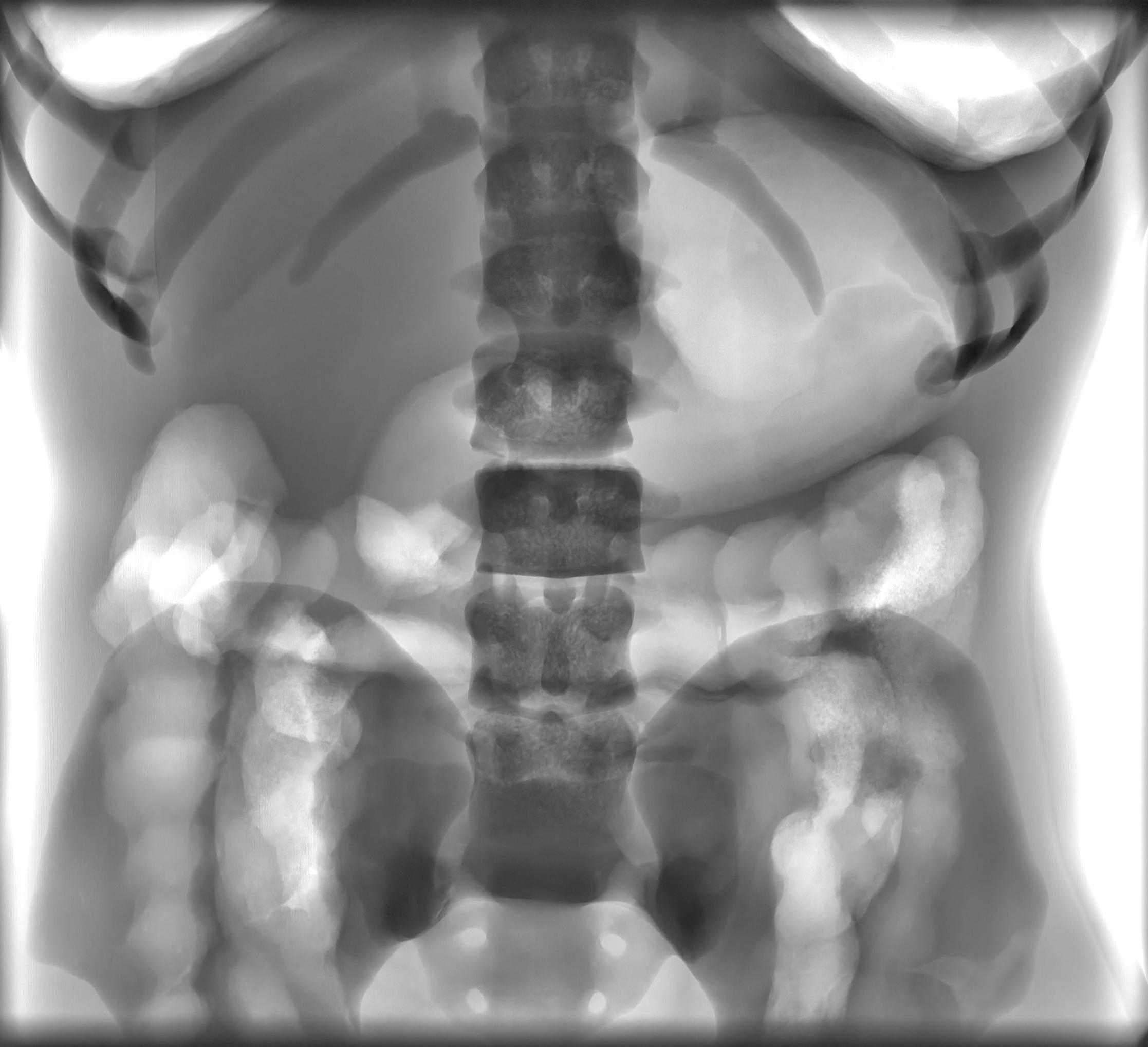 X-Ray Scans