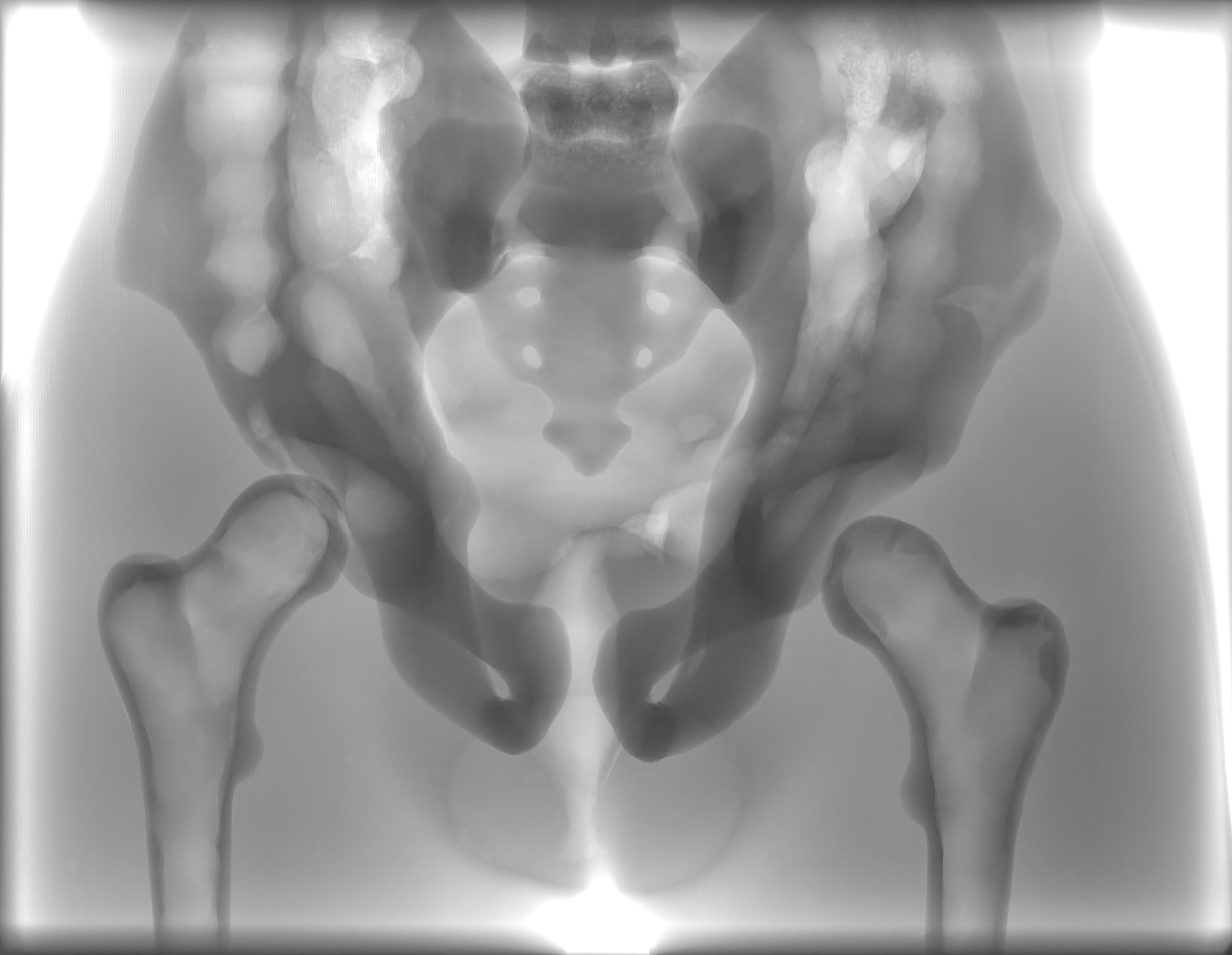 X-Ray Scans
