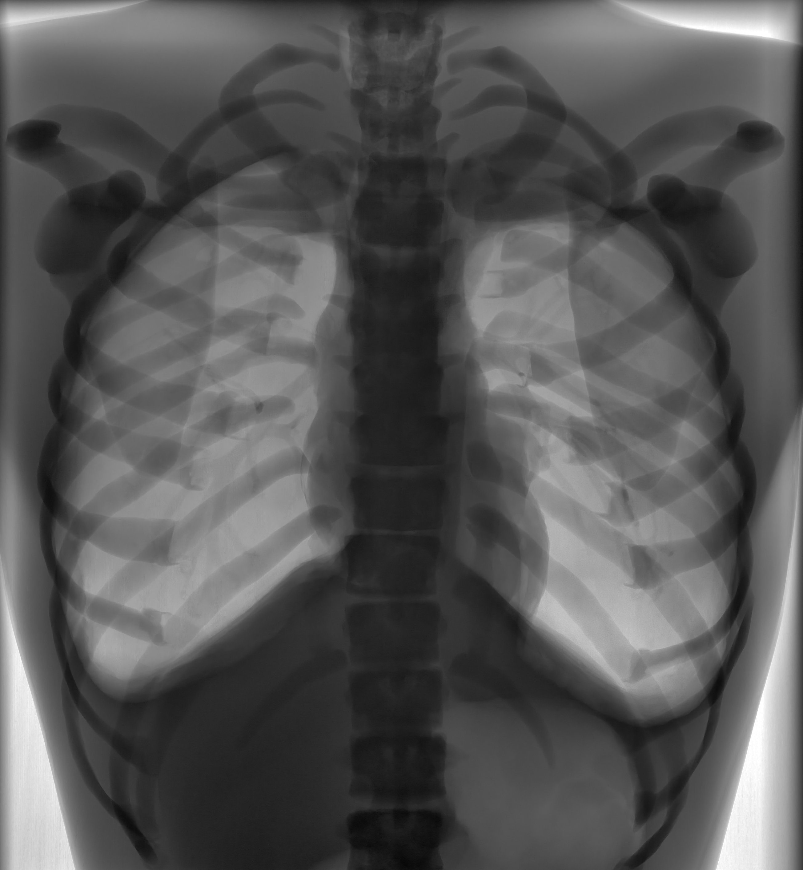 X-Ray Scans