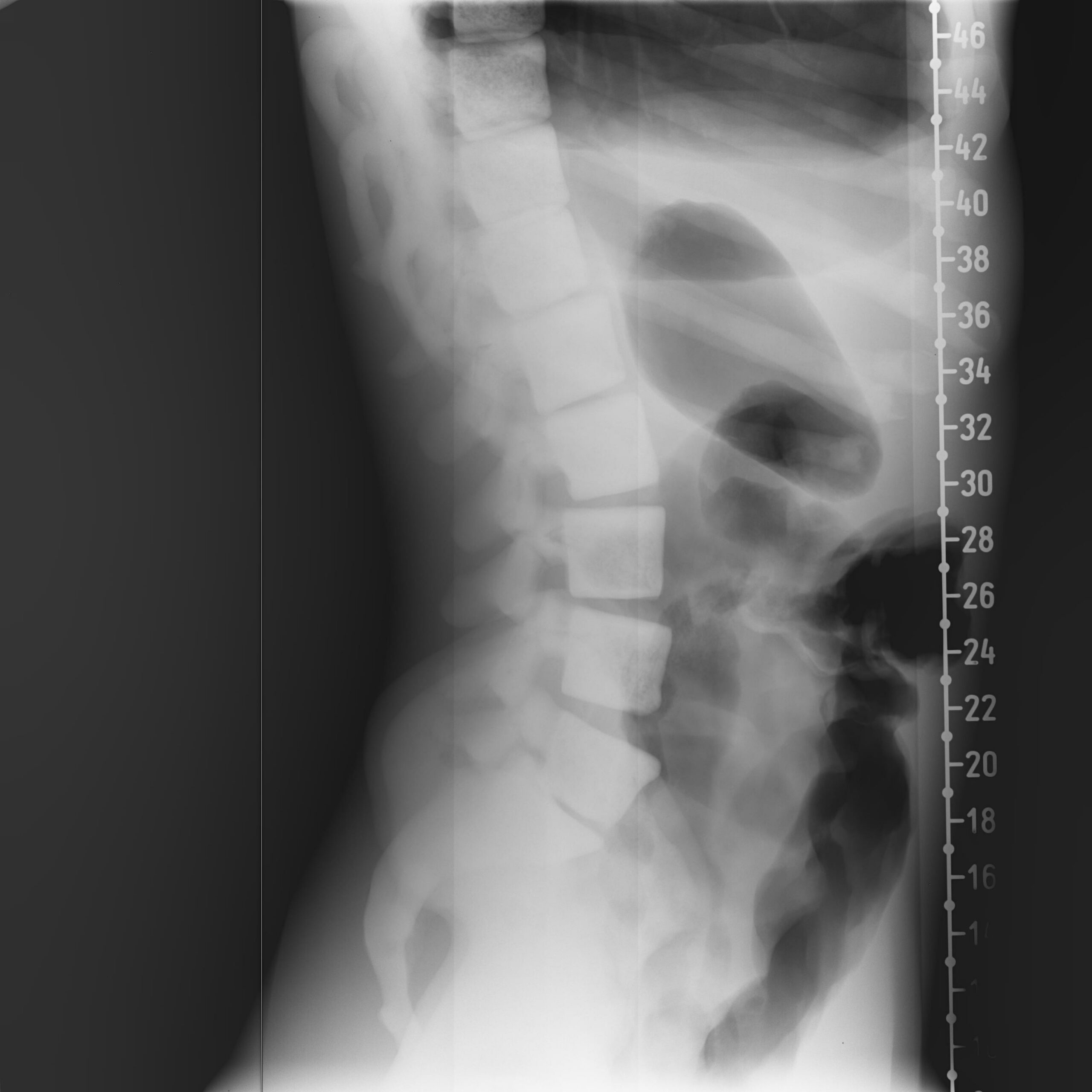 X-Ray Scans