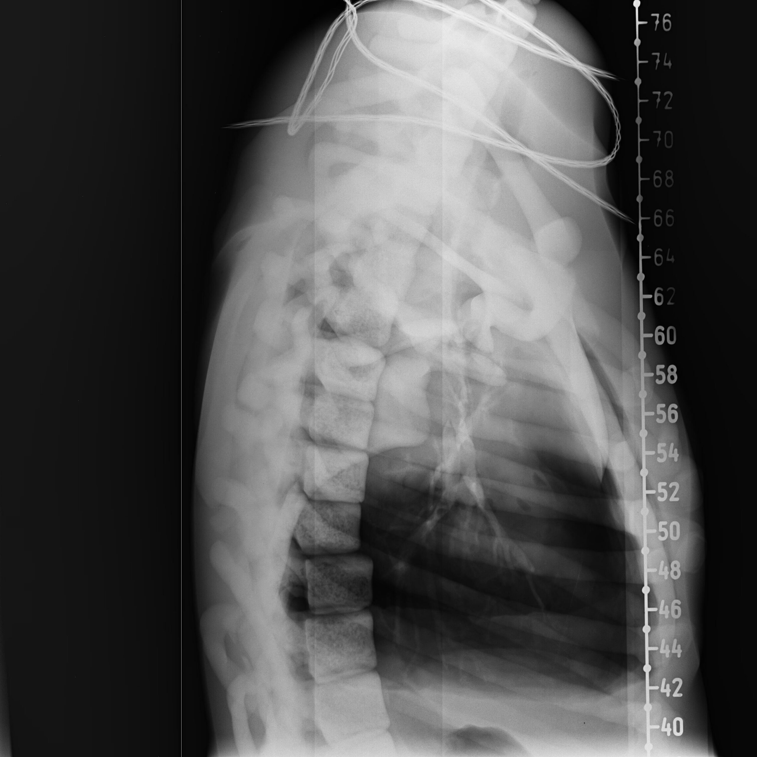 X-Ray Scans
