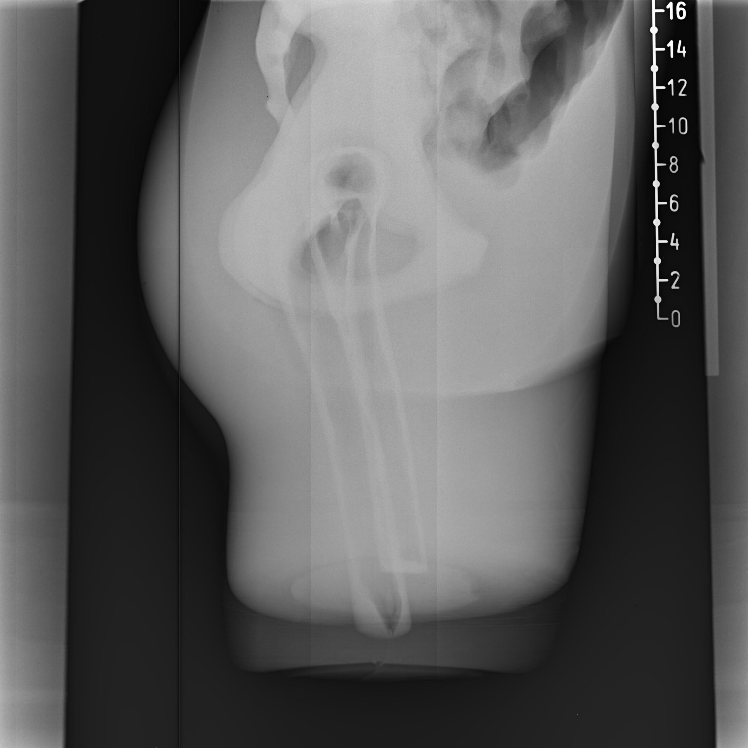 X-Ray Scans