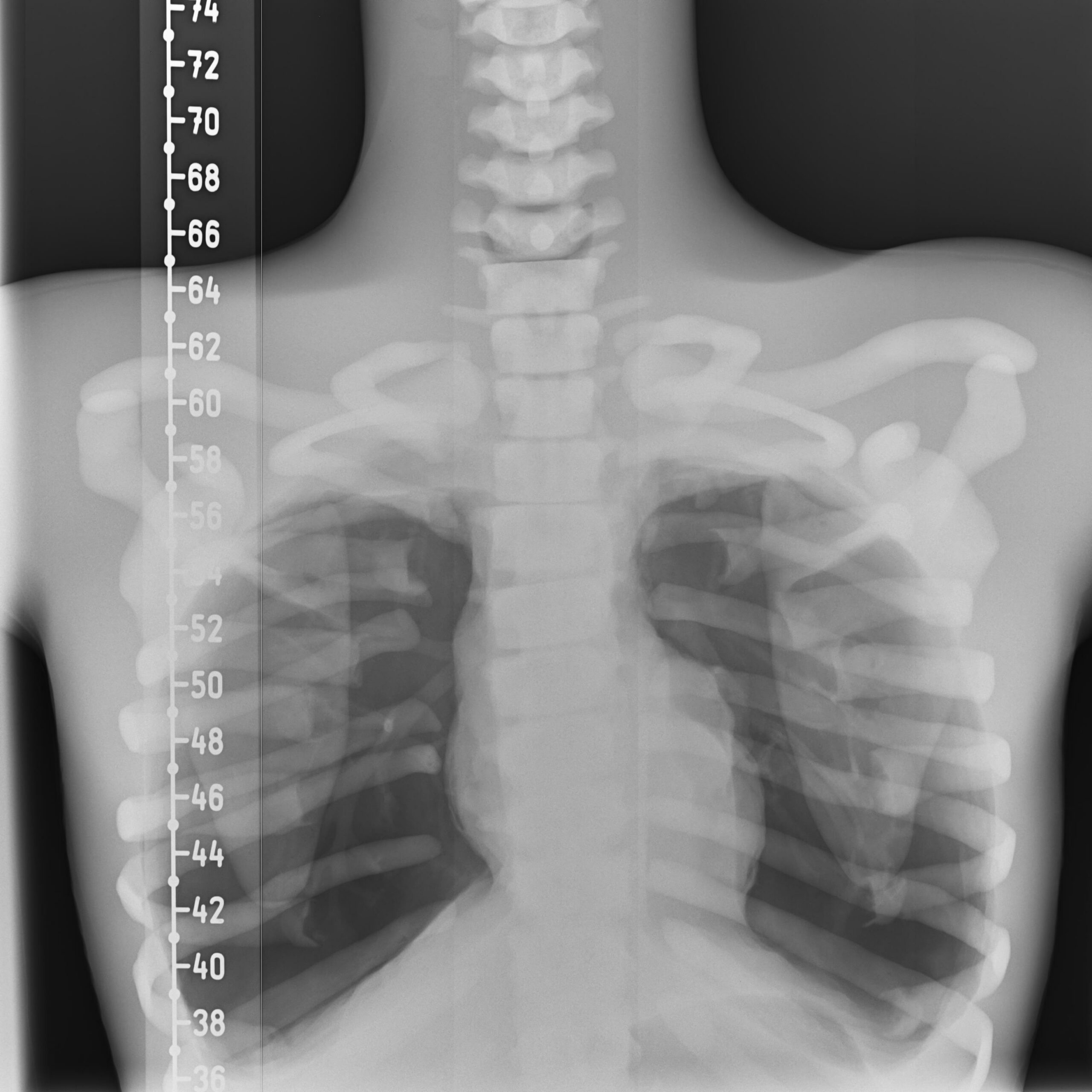 X-Ray Scans