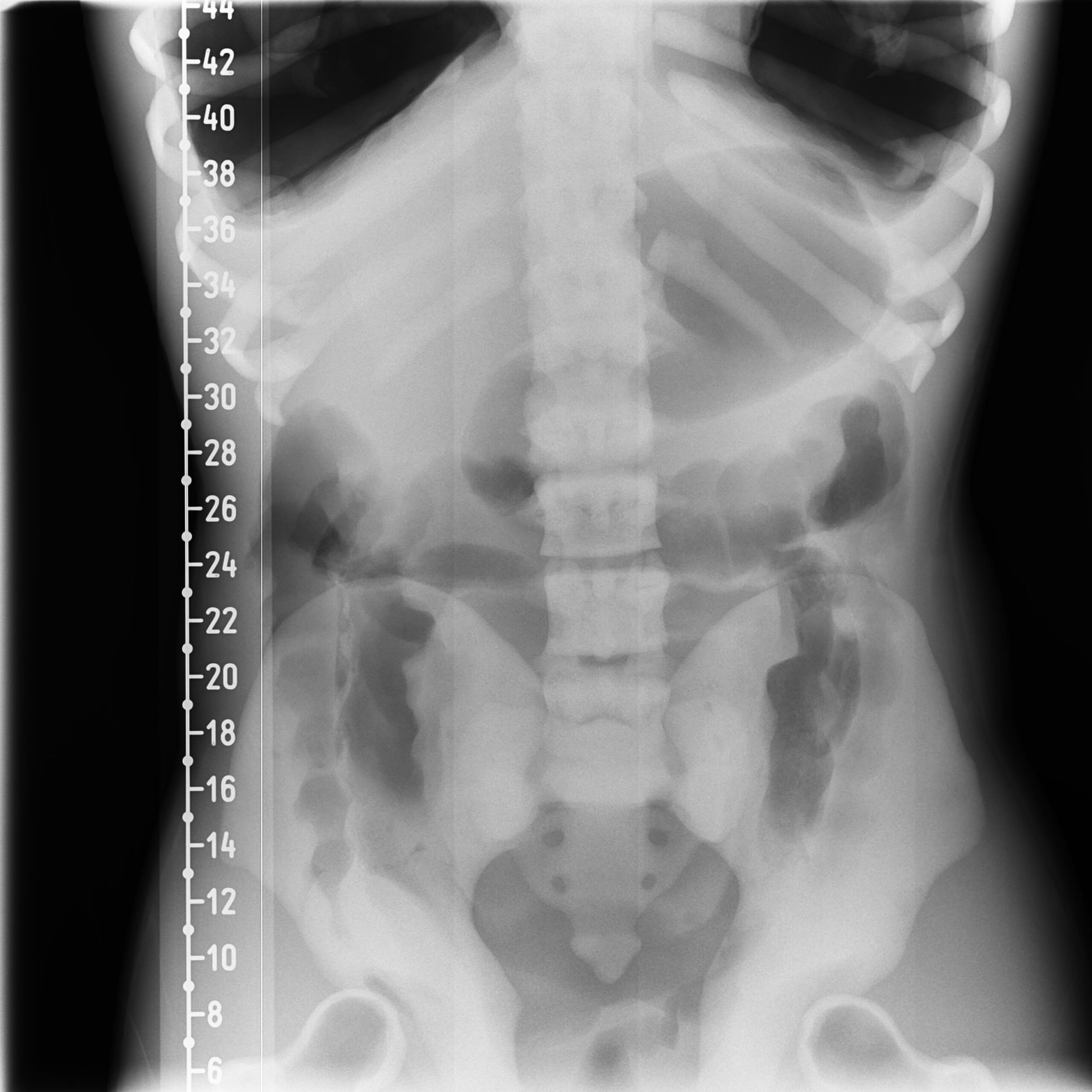 X-Ray Scans