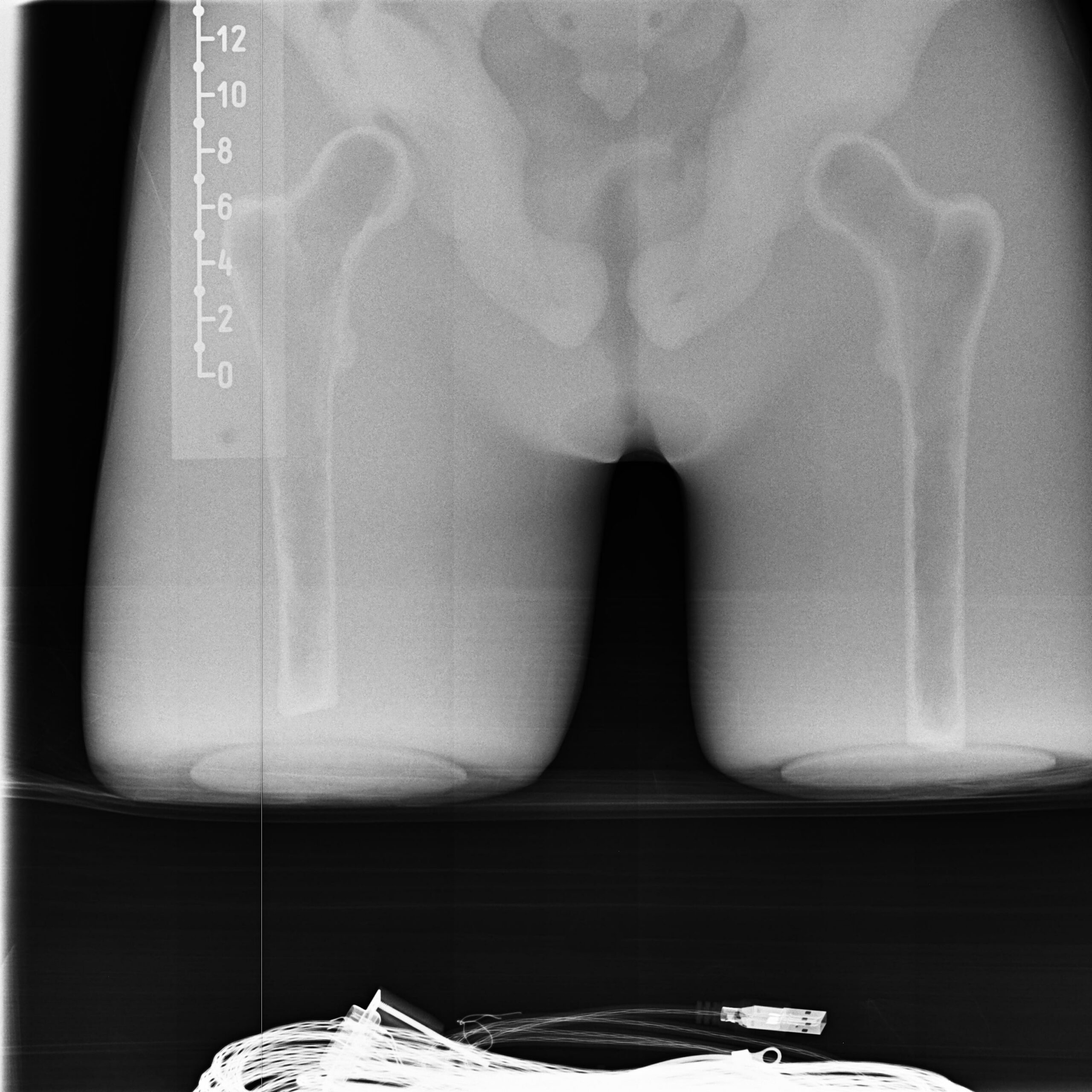 X-Ray Scans