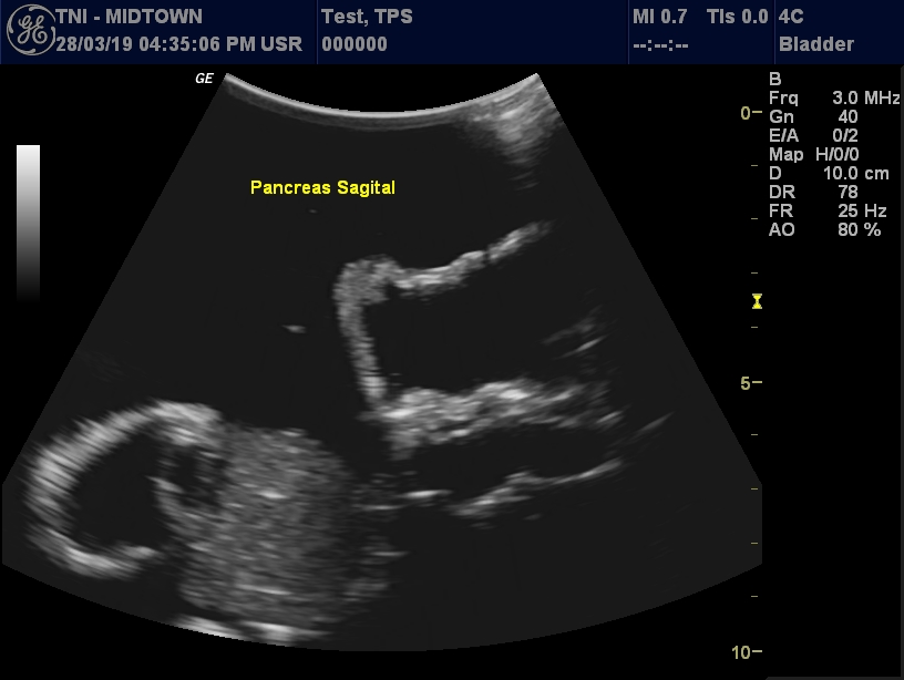 Ultrasound Scans