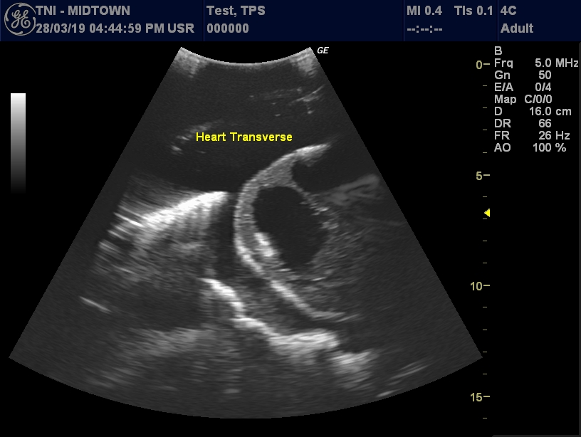 Ultrasound Scans