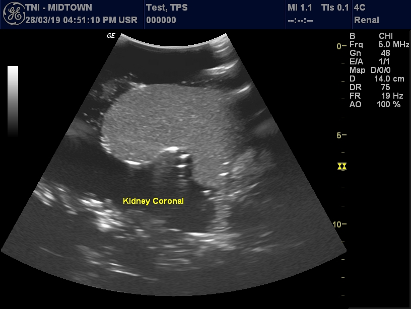 Ultrasound Scans