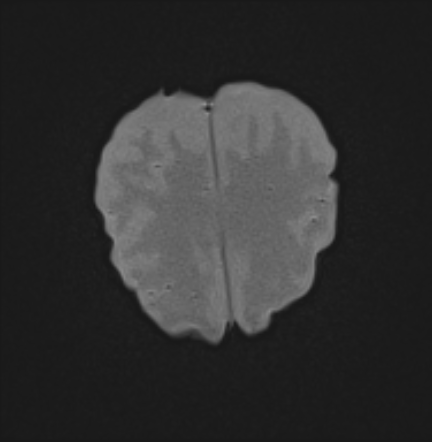 MRI Scans