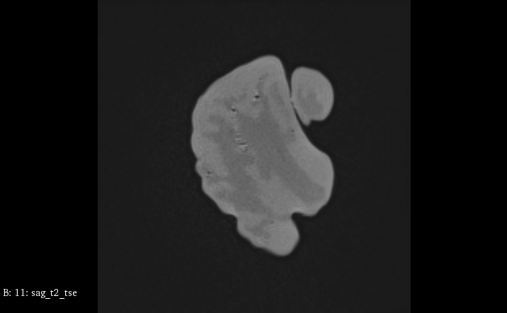 MRI Scans