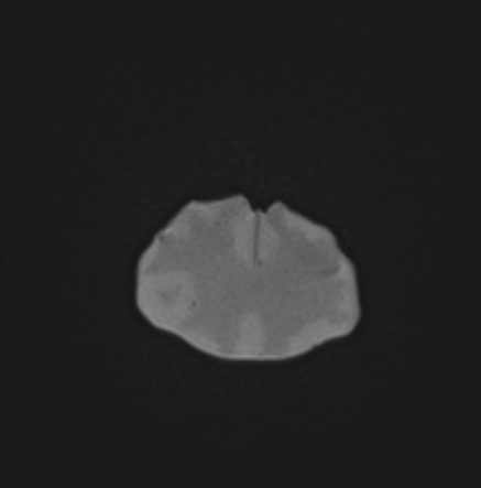 MRI Scans