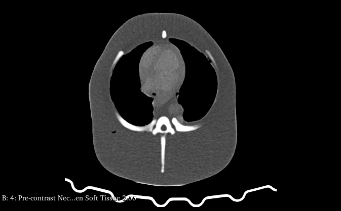 CT Scans