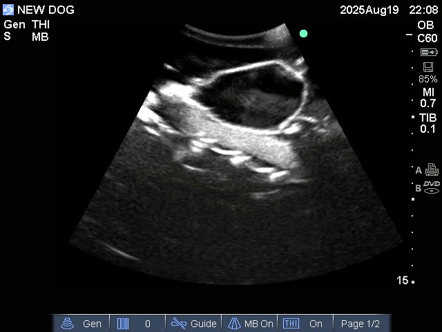 Ultrasound Scans