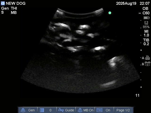 Ultrasound Scans