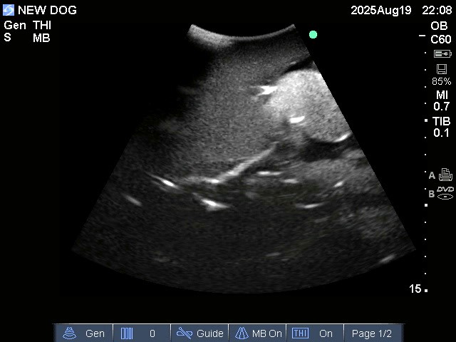 Ultrasound Scans