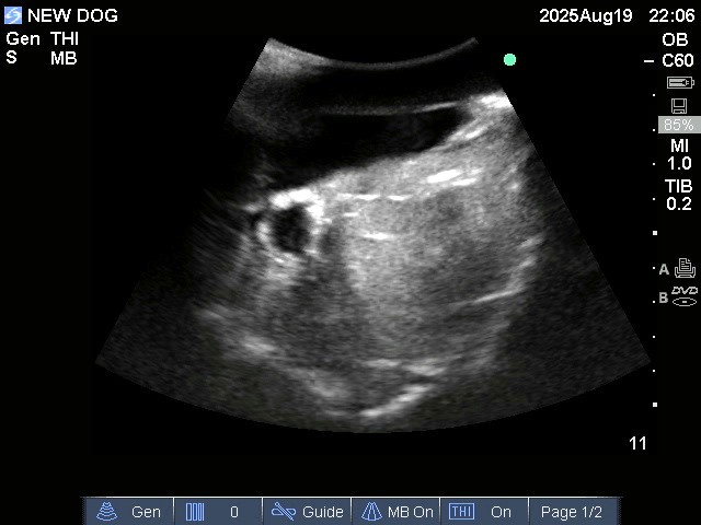 Ultrasound Scans