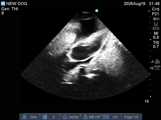 Ultrasound Scans