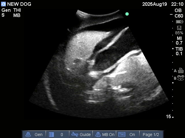 Ultrasound Scans