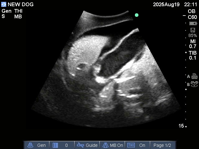 Ultrasound Scans
