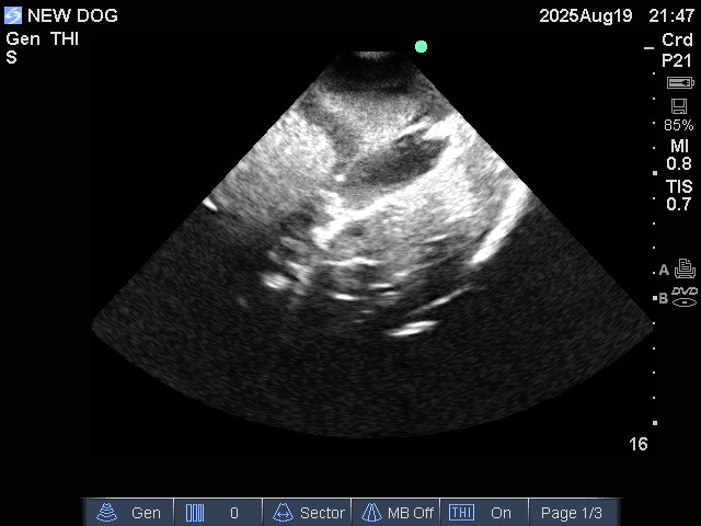 Ultrasound Scans