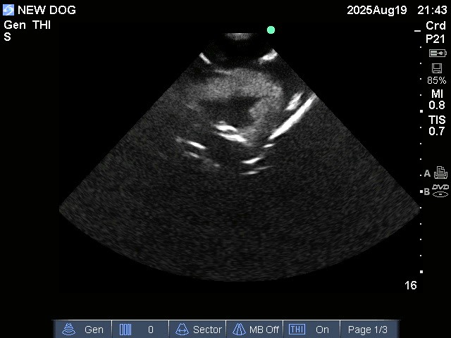 Ultrasound Scans