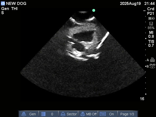 Ultrasound Scans