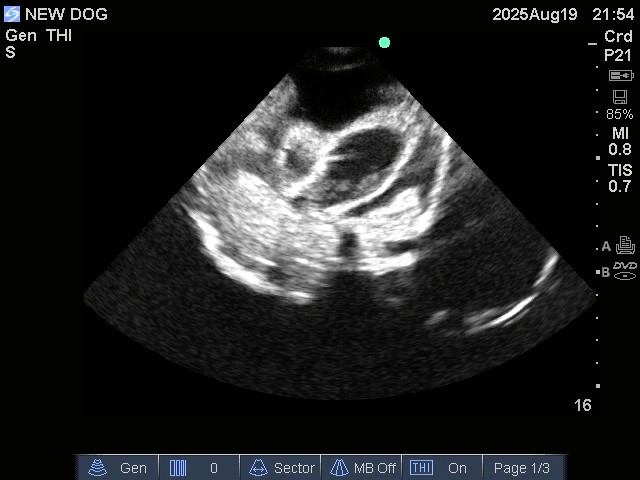 Ultrasound Scans