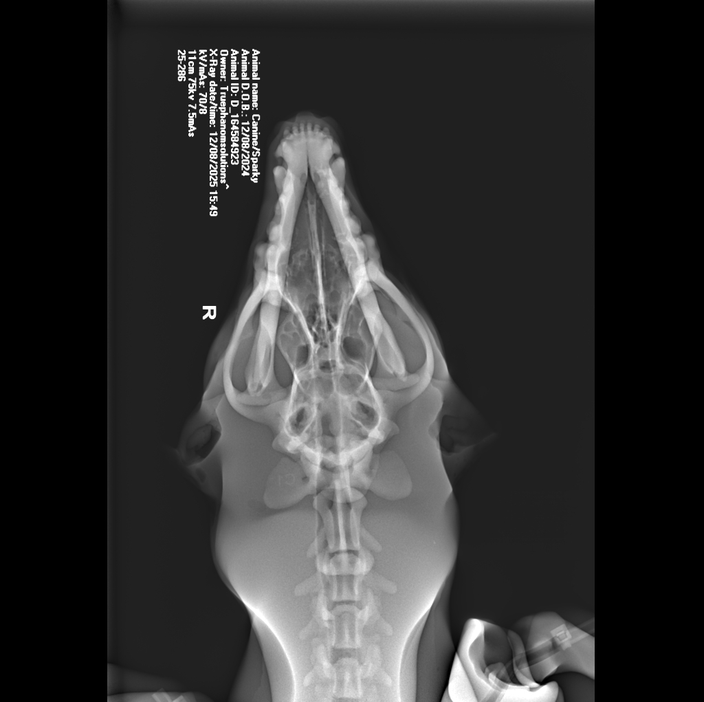 X-Ray Scans