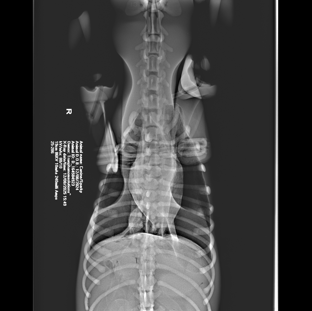 X-Ray Scans