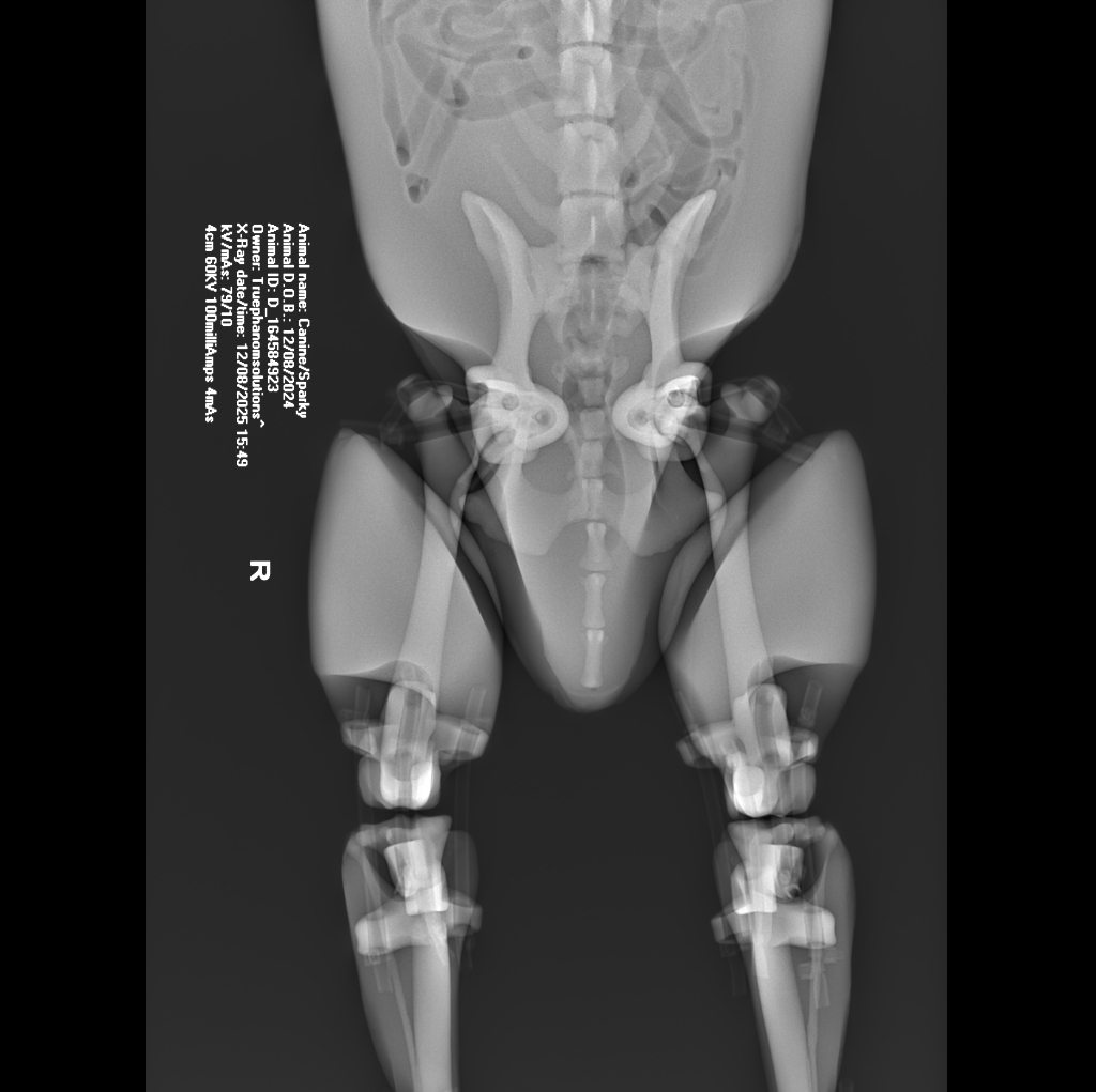 X-Ray Scans