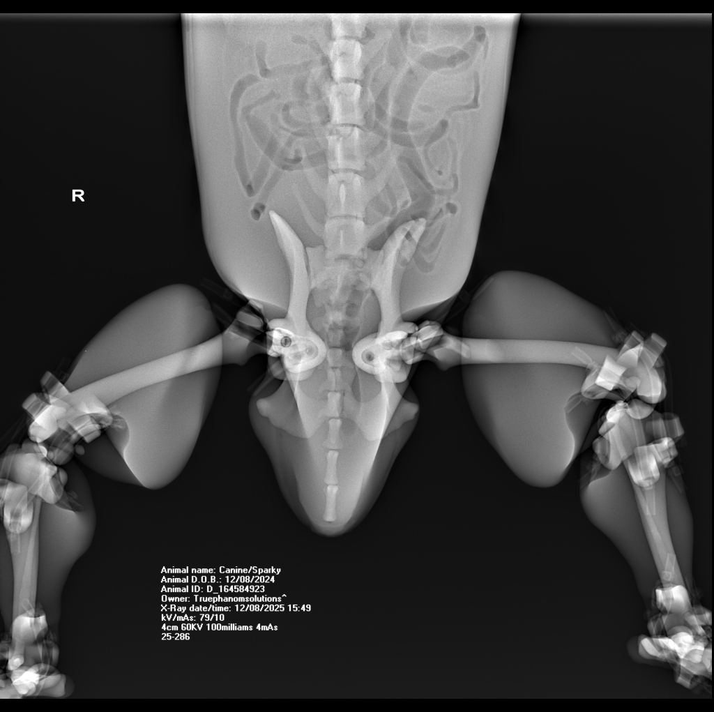 X-Ray Scans