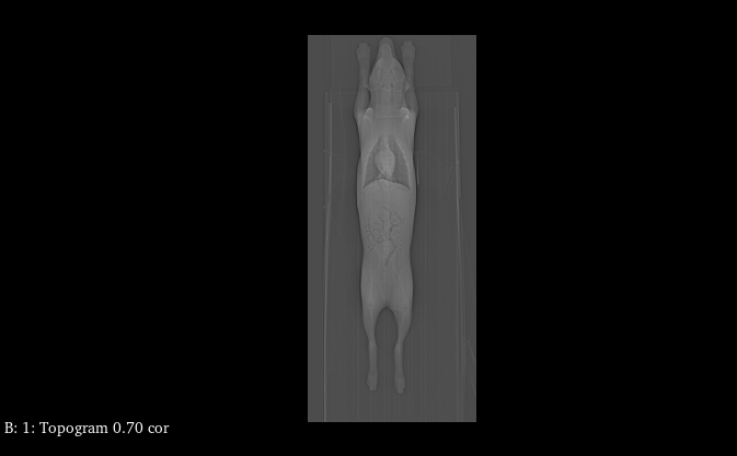 CT Scans