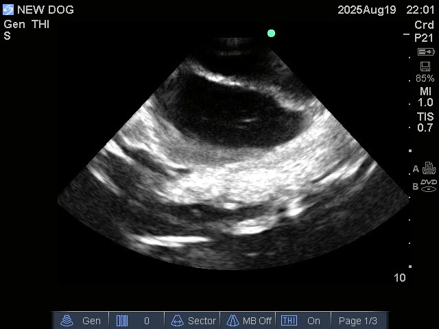 Ultrasound Scans