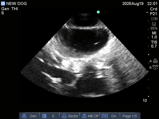 Ultrasound Scans