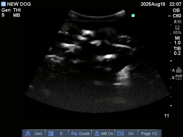 Ultrasound Scans