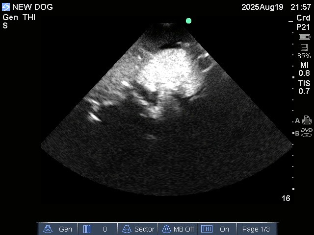 Ultrasound Scans