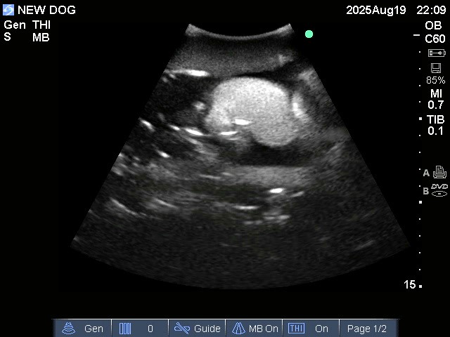 Ultrasound Scans