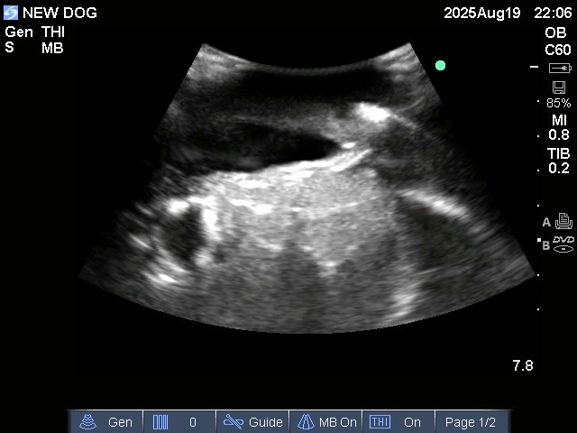 Ultrasound Scans