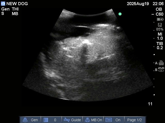Ultrasound Scans