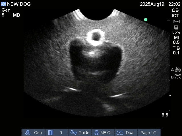 Ultrasound Scans