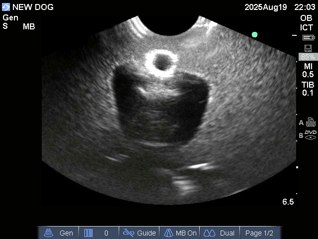 Ultrasound Scans
