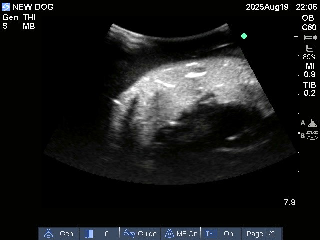 Ultrasound Scans