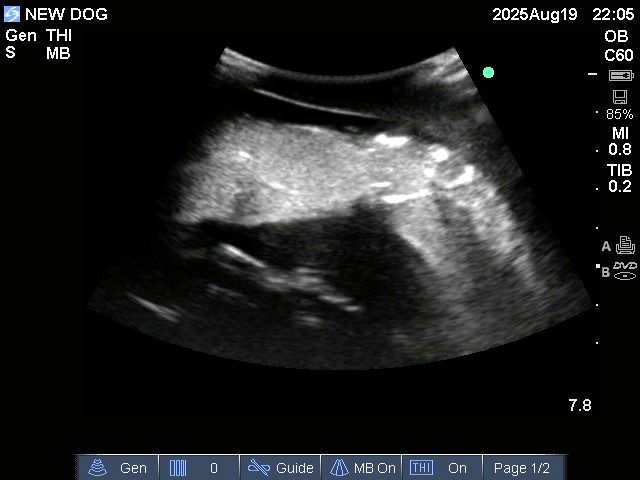 Ultrasound Scans