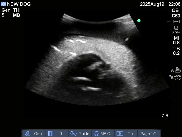 Ultrasound Scans